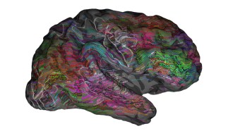 brain map