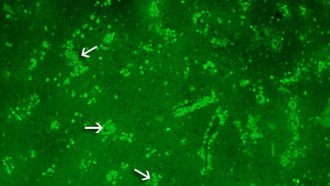 This section of brain came from a patient infected with N. fowleri. A fluorescent stain highlights, under the microscope, the tiny amoebas as bright green dots. Arrows point to some large clusters of them.
