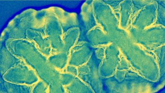 Aggregatibacter actinomycetemcomitans