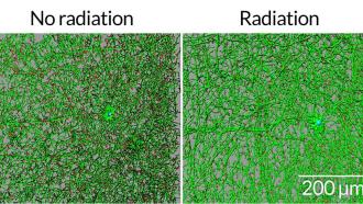 Mice data suggest that astronauts could suffer brain damage on the long trip to and from Mars. After being exposed to radiation, parts of nerve cells (green) in the brains of mice (right digital image) were shorter — and branched less — than in unexpo