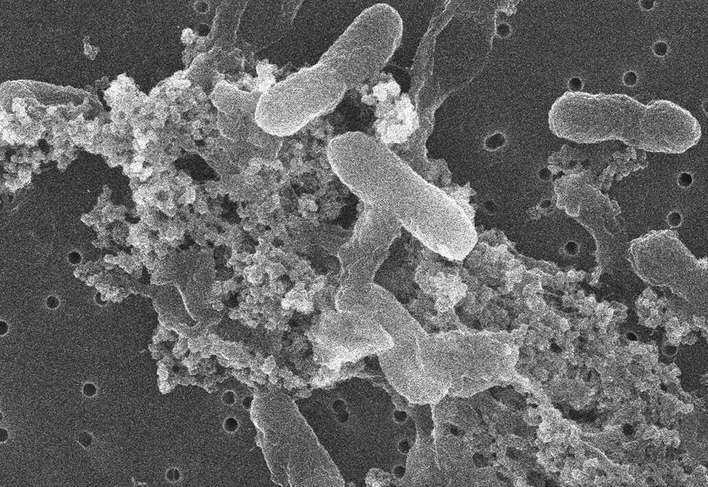 a scanning electron microscope image of Comamonas bacteria (rod shaped bacteria)Here’s a look through a microscope at the rod-shaped, plastic-munching bacteria Comamonas.