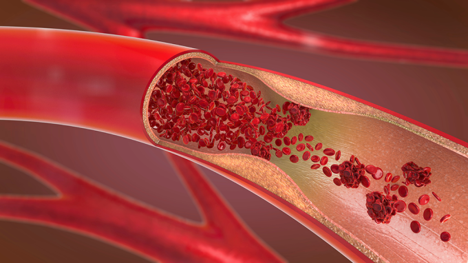 an illustration showing red blood cells inside a bending blood vessel