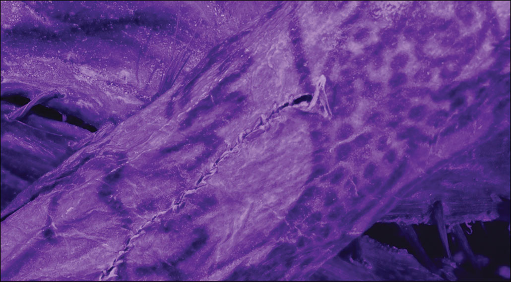 an infrared image showing ancient tattoos on the mummy's arm